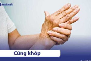 Cứng khớp là gì? Nguyên nhân, triệu chứng & cách điều trị