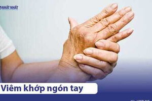 Viêm khớp ngón tay gây đau nhức: Nguyên nhân và cách điều trị