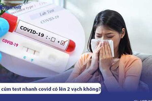 Bị cảm cúm test nhanh covid có lên 2 vạch dương tính không?