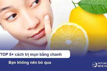 5+ cách trị mụn bằng chanh hiệu quả bạn không nên bỏ qua!