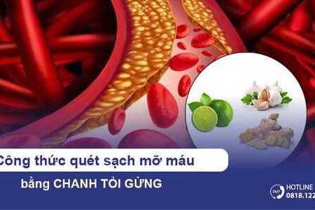 Công thức quét sạch mỡ máu bằng chanh tỏi gừng