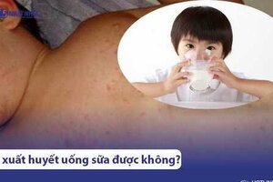 Người bị sốt xuất huyết có uống sữa được không?