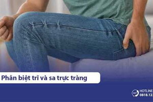 Cách phân biệt bệnh trĩ và sa trực tràng đúng nhất qua biểu hiện