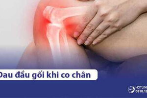 Đầu gối bị đau khi co chân là bệnh gì? Điều trị như thế nào?