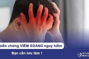 7 biến chứng viêm xoang nguy hiểm bạn cần lưu tâm