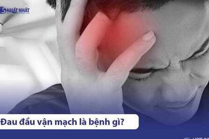 Bệnh đau đầu vận mạch là gì? Triệu chứng & Cách điều trị