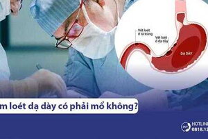 Viêm loét dạ dày có phải mổ không? 5 trường hợp phải mổ