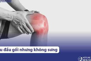 Đau đầu gối nhưng không sưng có sao không? Có cần đi khám không?