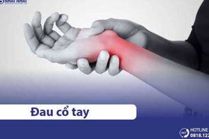 Đau cổ tay là bệnh gì? Nguyên nhân và cách chữa trị