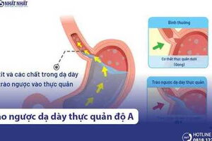 Viêm trào ngược dạ dày thực quản độ A là gì? Nguy hiểm không?