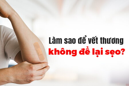 Làm sao để vết thương không để lại sẹo?