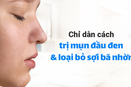 Chỉ dẫn cách trị mụn đầu đen và loại bỏ sợi bã nhờn