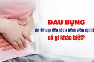 Đau bụng do rối loạn tiêu hóa và bệnh viêm đại tràng có gì khác biệt?