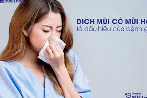 Dịch mũi có mùi hôi là dấu hiệu của bệnh gì?