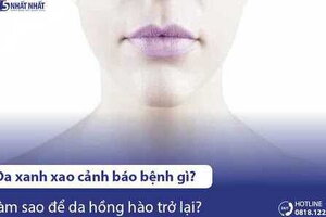 Da xanh xao nhợt nhạt cảnh báo bệnh gì? Làm sao để da hồng hào trở lại?