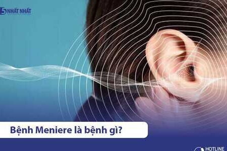 Bệnh Meniere là bệnh gì? Có chữa khỏi được không?