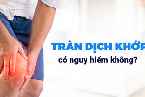 Giải đáp: Tràn dịch khớp có nguy hiểm không?