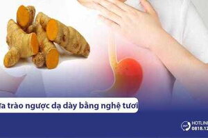 6+ Cách dùng nghệ tươi chữa trào ngược dạ dày thực quản hiệu quả cao