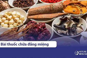 Bật mí 3 bài thuốc Đông y chữa đắng miệng an toàn, hiệu quả