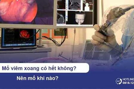 Mổ viêm xoang có hết không? Nên mổ khi nào?