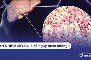 Gan nhiễm mỡ độ 3 có nguy hiểm không?