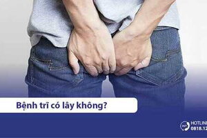 Bệnh trĩ có lây không? Ngồi chung ghế có sao không?