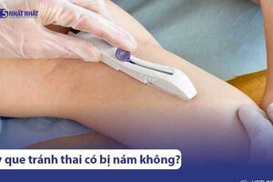 Cấy que tránh thai có bị nám da hay không? Khắc phục thế nào?