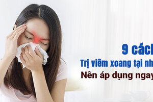 9 cách trị viêm xoang tại nhà nên áp dụng ngay!