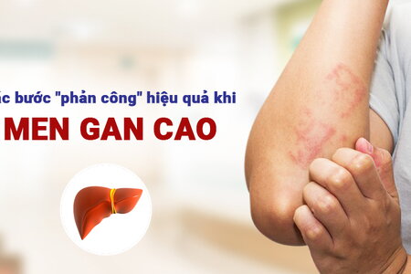 Các bước “phản công” hiệu quả khi men gan cao