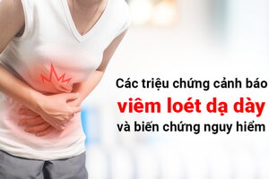 Các triệu chứng cảnh báo viêm loét dạ dày và biến chứng nguy hiểm