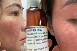Hàng loạt ca biến chứng làm đẹp siêu tốc đón Tết vì tin 'bác sĩ tự phong' tràn ngập mạng xã hội