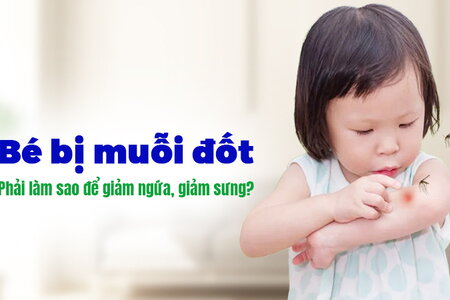 Bé bị muỗi đốt, phải làm sao để giảm ngứa, giảm sưng cho bé?