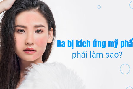 Bạn có biết: Da bị kích ứng mỹ phẩm, phải làm sao?