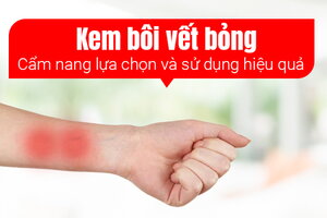 Kem bôi vết bỏng: Cẩm nang lựa chọn và sử dụng hiệu quả