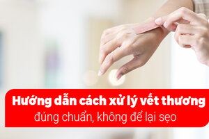 Hướng dẫn cách xử lý vết thương đúng chuẩn, không để lại sẹo