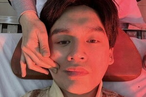 Nguyễn Trần Trung Quân liệt dây thần kinh ngoại biên số 7 sau đêm diễn ở Hải Phòng