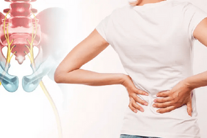 Nhận biết cơn đau thần kinh tọa và hình ảnh chẩn đoán rõ nhất