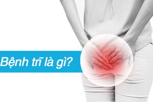 Bệnh trĩ là gì? Giải đáp mọi thắc mắc về bệnh trĩ