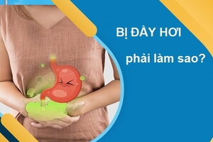 Bị đầy hơi phải làm sao: 10 cách cứu nguy ngay lập tức