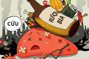 Dấu hiệu dễ nhận biết bệnh viêm gan do rượu