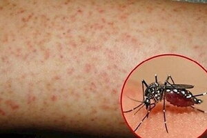 Hà Nội ghi nhận hơn 500 ca mắc sốt xuất huyết, tăng gấp 3 lần so với cùng kỳ