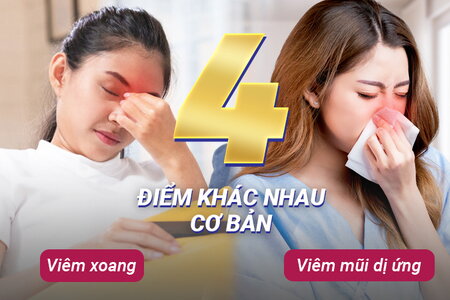 4 điểm khác nhau cơ bản giữa viêm xoang và viêm mũi dị ứng