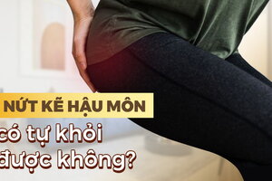 Giải đáp thắc mắc: Nứt kẽ hậu môn có tự khỏi không?