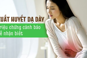 Xuất huyết dạ dày triệu chứng cảnh báo dễ nhận biết