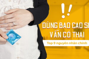 Dùng bao cao su vẫn có thai: top 9 nguyên nhân chính