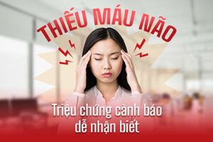 Thiếu máu não triệu chứng cảnh báo dễ nhận biết