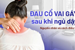 Đau cổ gáy sau khi ngủ dậy: Nguyên nhân và cách điều trị hiệu quả