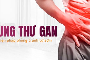 Ung thư gan: Các biện pháp phòng tránh ngay từ sớm nên thực hiện ngay