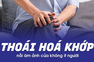 Thoái hóa khớp - nỗi ám ảnh của không ít người