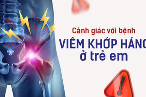 Cảnh giác với bệnh viêm khớp háng ở trẻ em